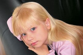 Ohren anlegen Bild nach OP 5